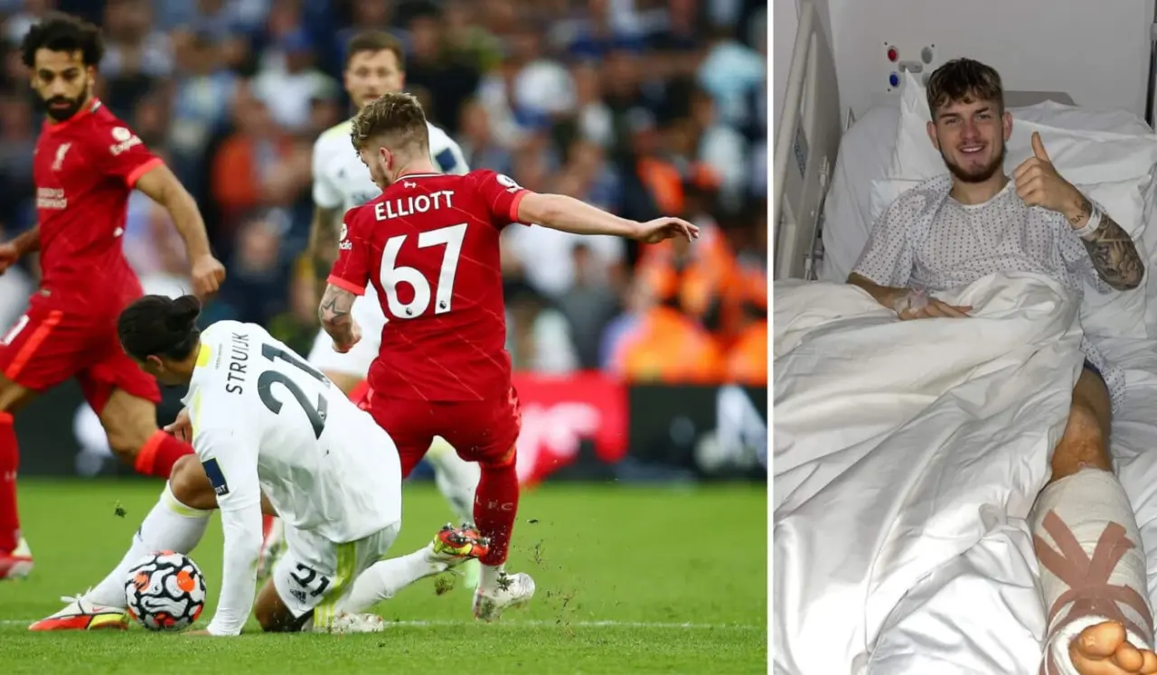 Harvey Elliott Ankle Break